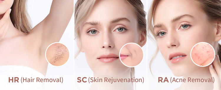 IPL Hair Removal Safe Permanent Painless Epilator Face Body Arms Leg Whole Body Treatment For Men Women Home Use by Home for Health and Beauty