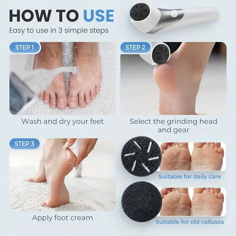 Electric Foot Callus Remover Rechargeable Pedicure Kit 2 Speed Exfoliating Tool for Smooth Heels by Home for Health and Beauty