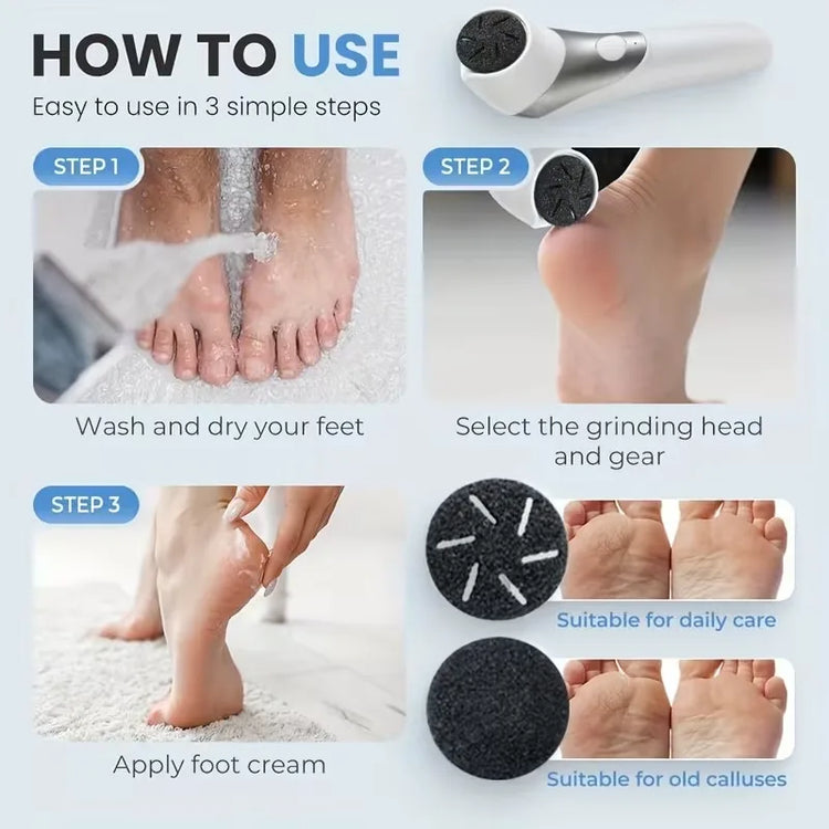 Electric Foot Callus Remover Rechargeable Pedicure Kit 2 Speed Exfoliating Tool for Smooth Heels by Home for Health and Beauty