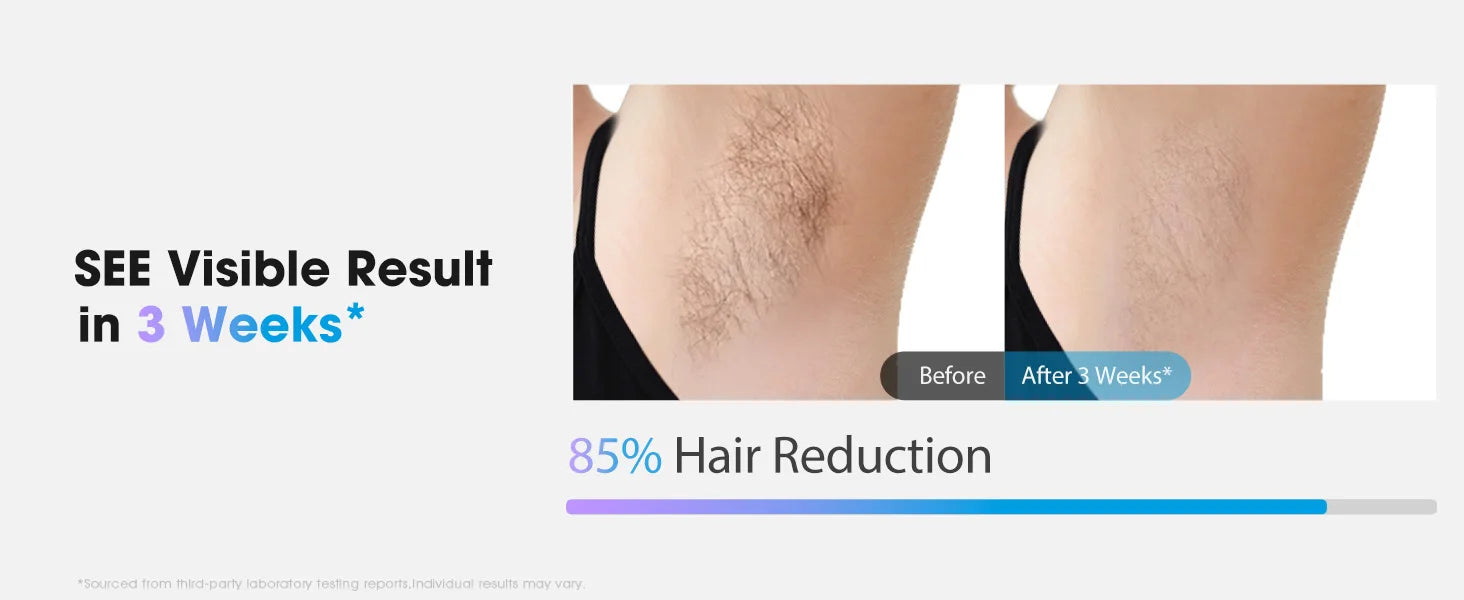 IPL Laser Hair Removal Device for Women Men 45°F Ice-Cooling for Painless & Long-Lasting Results Laser for Full Body Bikini by Home for Health and Beauty
