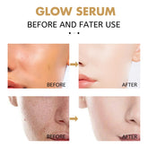 Eelhoe Whitening Firming Hydrating Serum Deep Repair Facial Essence by Home for Health and Beauty