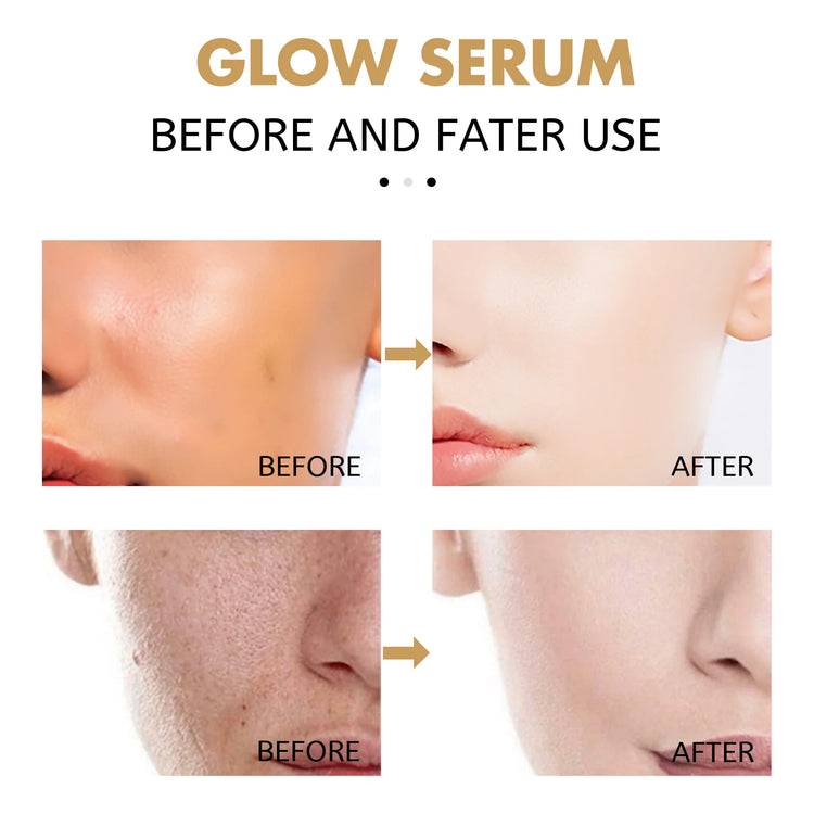 Eelhoe Whitening Firming Hydrating Serum Deep Repair Facial Essence by Home for Health and Beauty