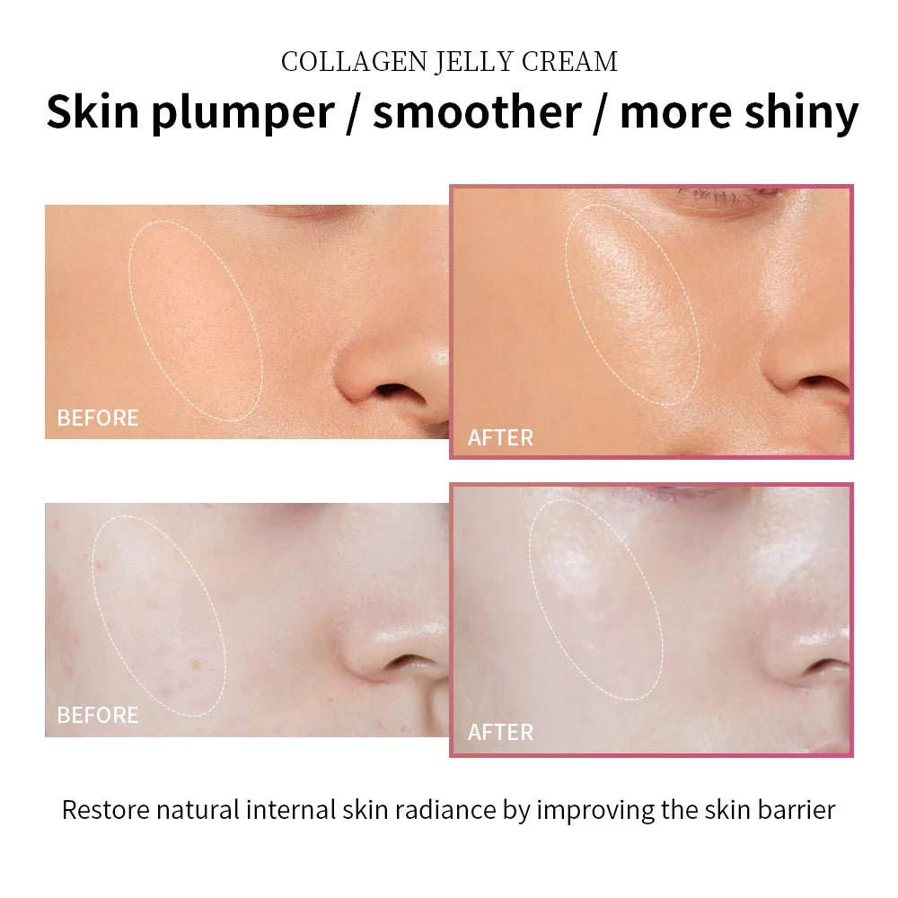 Anti Aging Collagen Face Cream 100ml Niacinamide Moisturizer Hydrating Gel For Tightening Soothing Firmness Skincare by Home for Health and Beauty