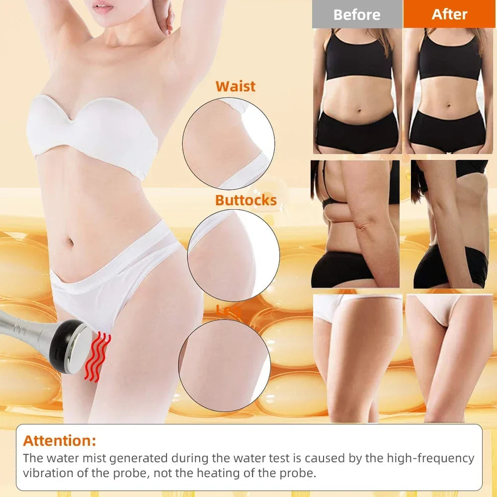 Cavitation Ultrasonic Body Slimming Machine For Skin Tightening by Home for Health and Beauty