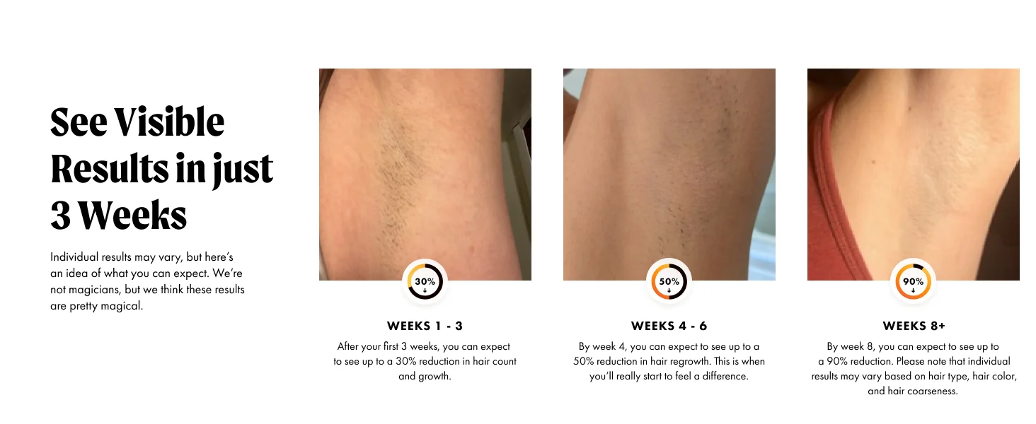 IPL Hair Removal Safe Permanent Painless Epilator Face Body Arms Leg Whole Body Treatment For Men Women Home Use by Home for Health and Beauty
