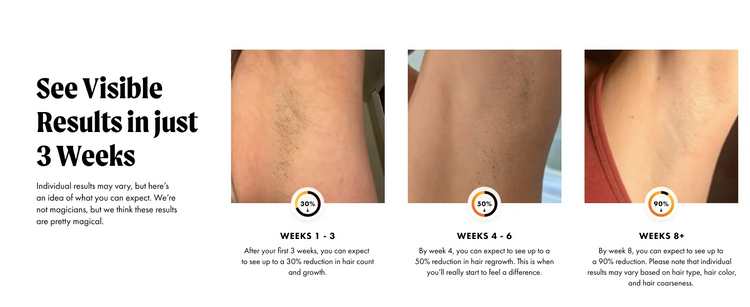 IPL Hair Removal Safe Permanent Painless Epilator Face Body Arms Leg Whole Body Treatment For Men Women Home Use by Home for Health and Beauty