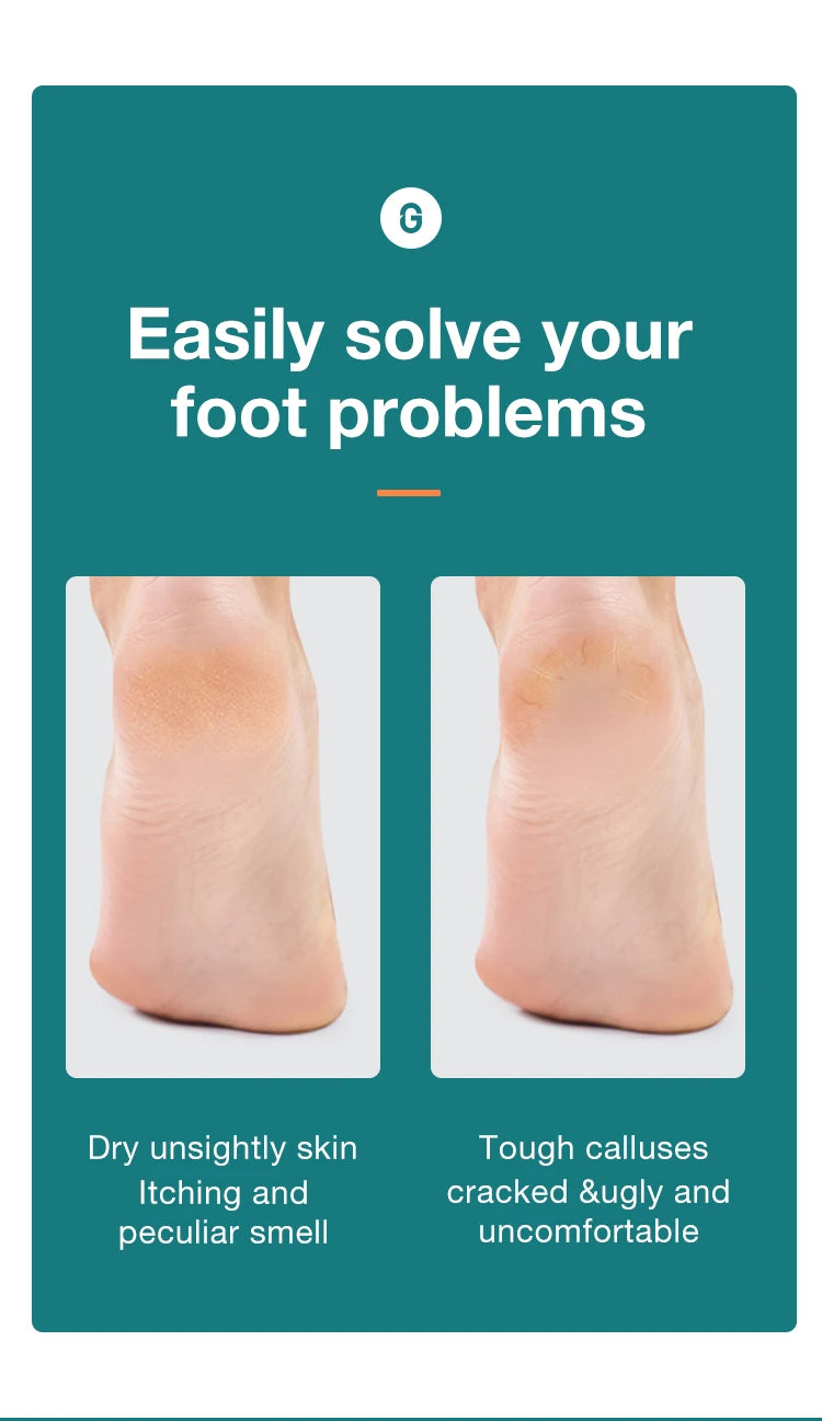 MR.GREEN Foot File Double Sided Callus Remover For Dead Skin Professional Pedicure Tools Callous Scraper Foot Sander Heel Filer by Home for Health and Beauty