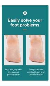 MR.GREEN Foot File Double Sided Callus Remover For Dead Skin Professional Pedicure Tools Callous Scraper Foot Sander Heel Filer by Home for Health and Beauty