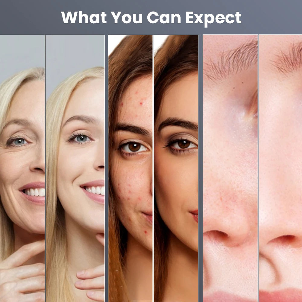 3 In 1 Hydro Dermabrasion Facial Cleansing Machine