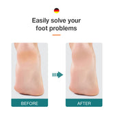 MR.GREEN Foot File Double Sided Callus Remover For Dead Skin Professional Pedicure Tools Callous Scraper Foot Sander Heel Filer by Home for Health and Beauty