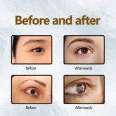 Eelhoe Eyelash Enhancing Serum Nourishing Natural Lengthening Lashes by Home for Health and Beauty