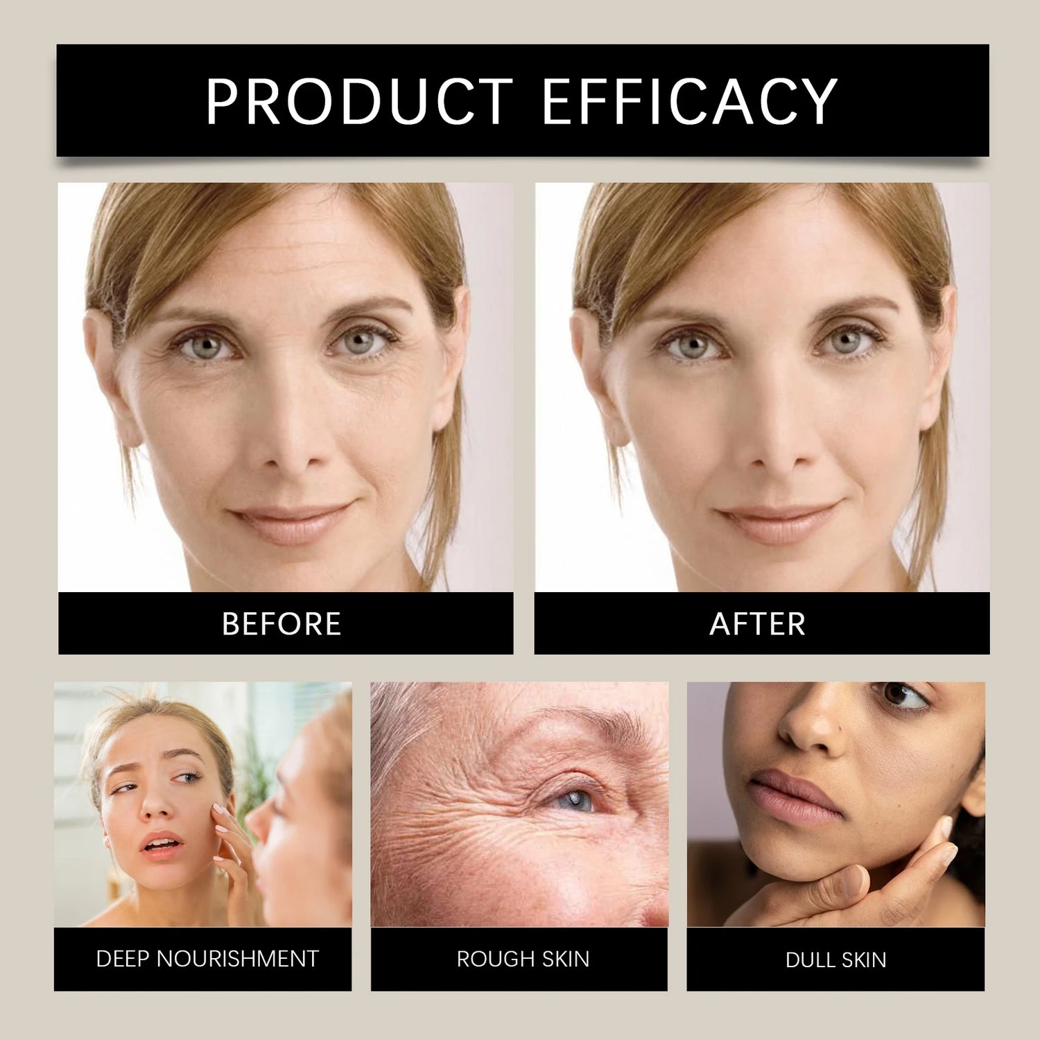 Bee Venom Serum Increase Elasticity Reduce Redness Firming Lifting Skin Care Stick Eliminates Wrinkles Improve Saggin Skin by Home for Health and Beauty
