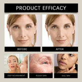 Bee Venom Serum Increase Elasticity Reduce Redness Firming Lifting Skin Care Stick Eliminates Wrinkles Improve Saggin Skin by Home for Health and Beauty