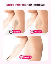 IPL Hair Removal Epilator Laser Permanent Painless Machine by Home for Health and Beauty