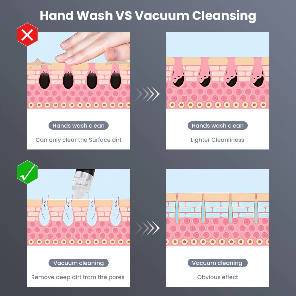 3 In 1 Hydro Dermabrasion Facial Cleansing Machine