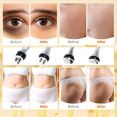 Cavitation Ultrasonic Body Slimming Machine For Skin Tightening by Home for Health and Beauty