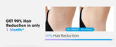 IPL Laser Hair Removal Device for Women Men 45°F Ice-Cooling for Painless & Long-Lasting Results Laser for Full Body Bikini by Home for Health and Beauty